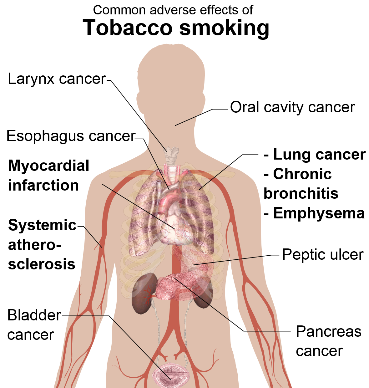 Adverse effects of tobacco smoking