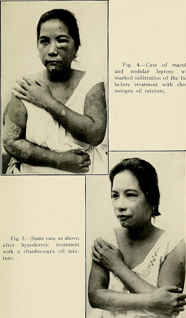 Handbook of medical treatment (1919)