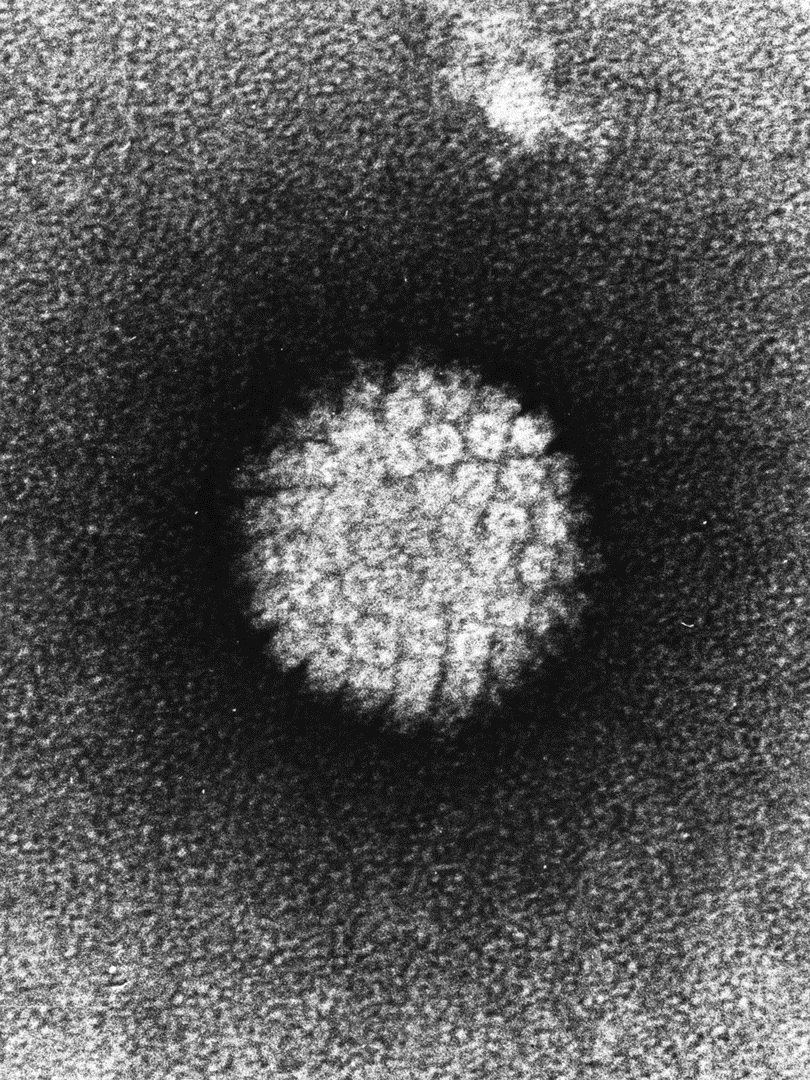 Papilloma Virus (HPV)