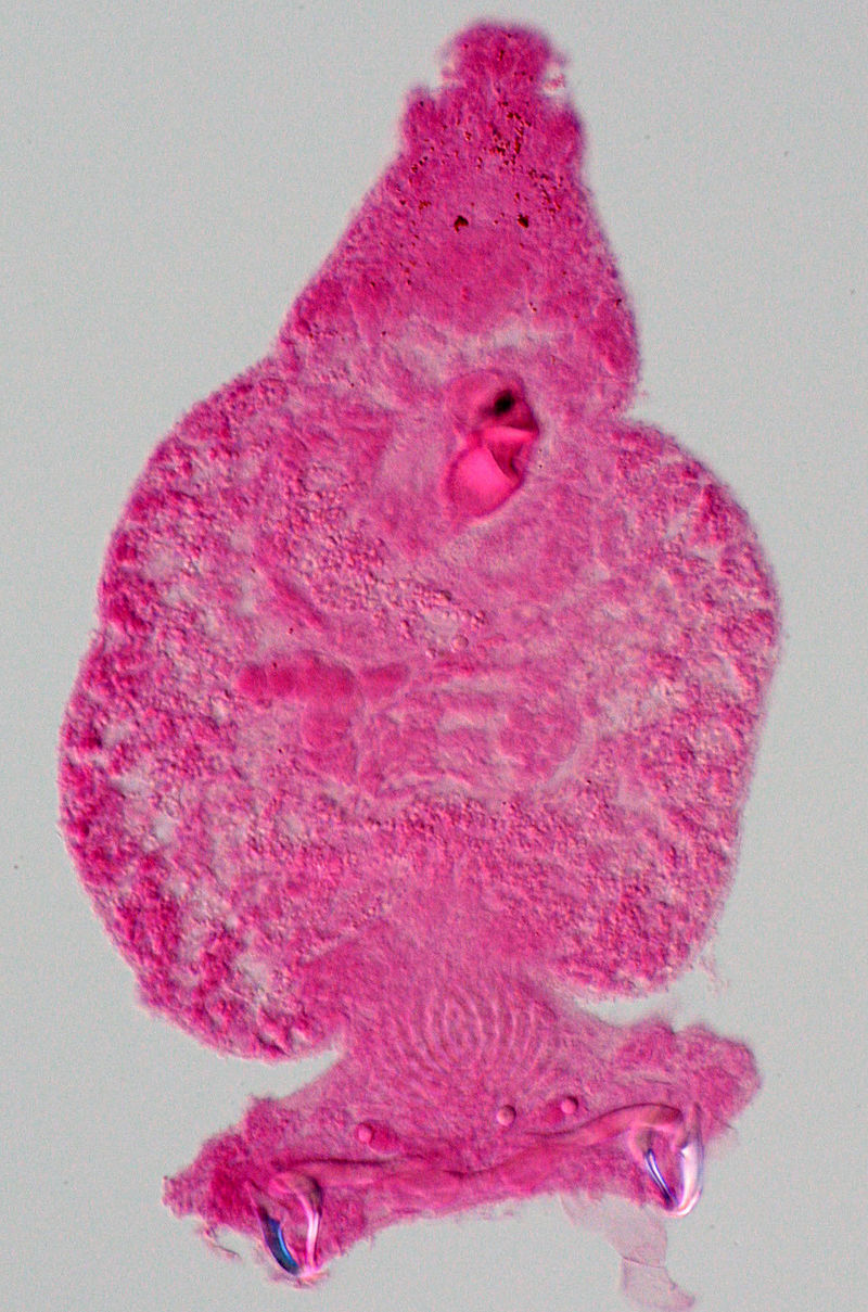 Carmine red is being used as a dye for microscopy in this image.