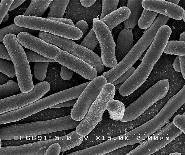 common bacterial nemesis, Escherichia coli