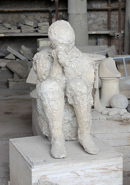 body cast with hands in prayer position