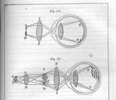 Plympton and Parker's version of the drawing