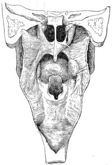  A glance into the human pharynx where sound is shaped