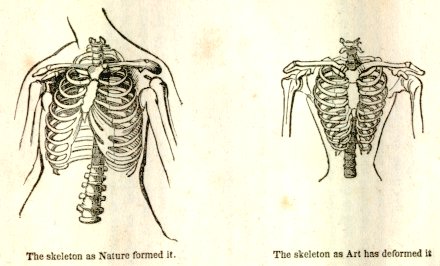 Ticknor's only illustrations deal with the folly of women's tight corsets.