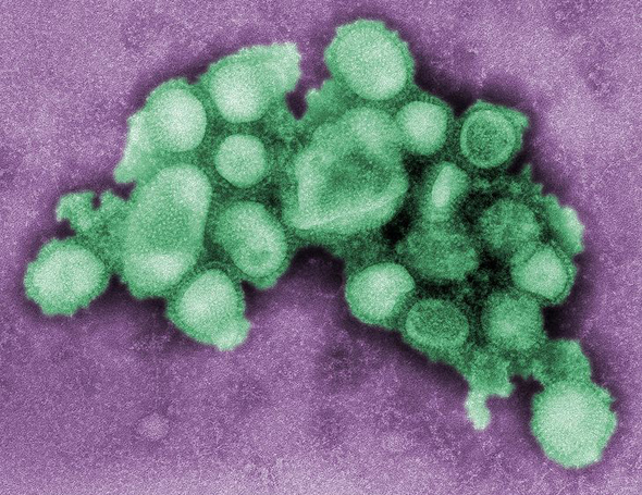 H1N1 flu virus picture
